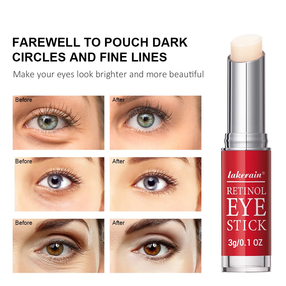 Stick Rétinol Contour des Yeux – Réduit Poches & Cernes