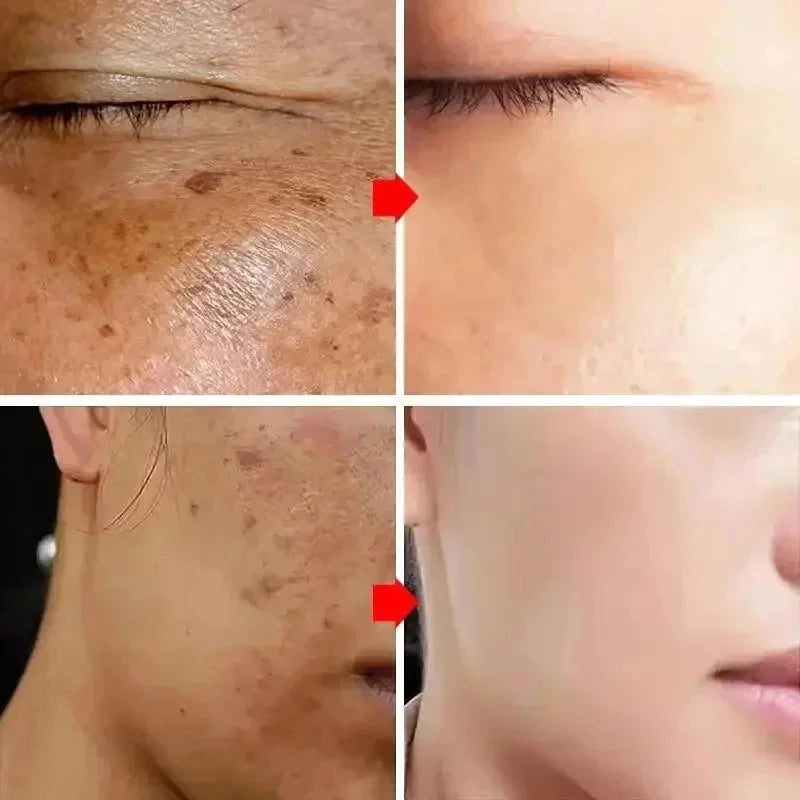 Crème Éclat Anti-Taches – Unifie et Illumine le Teint