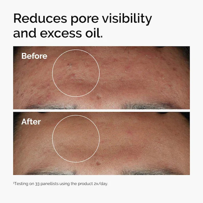 Sérum Niacinamide 10% + Zinc — Anti-taches & Pores Resserrés