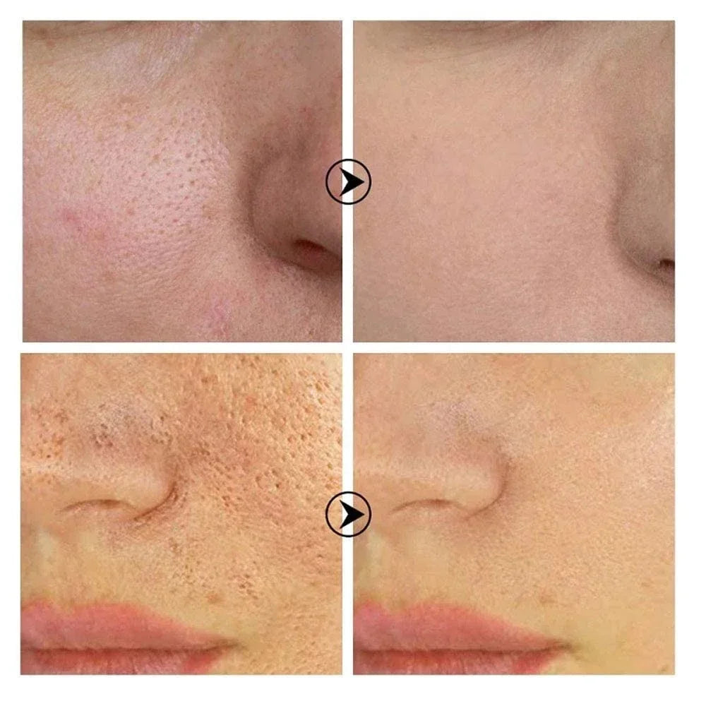 Sérum Visage Texture & Éclat – Rétinol & Niacinamide